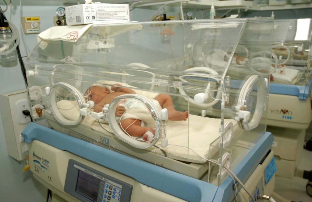 Nenê recebe tratamento em UTI: um bebê na Espanha nasceu com anticorpos contra o coronavírus