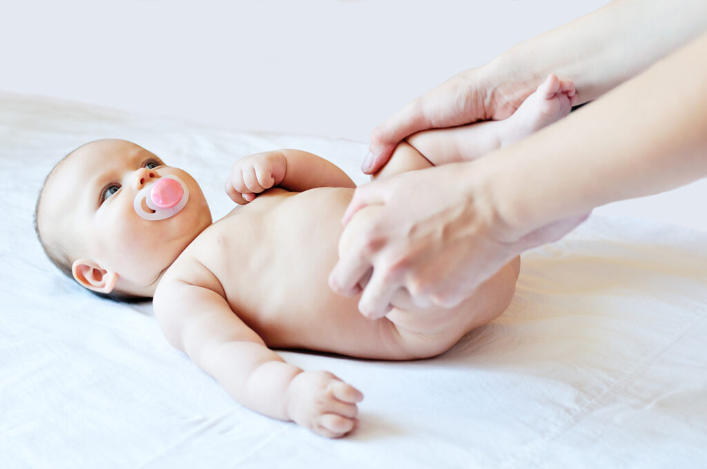 Adulto ajeita pernas de bebê com DDQ displasia de desenvolvimento do quadril